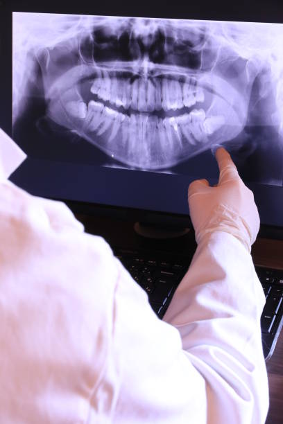 Best Root Canal Emergency Dentist  in Maltby, WA